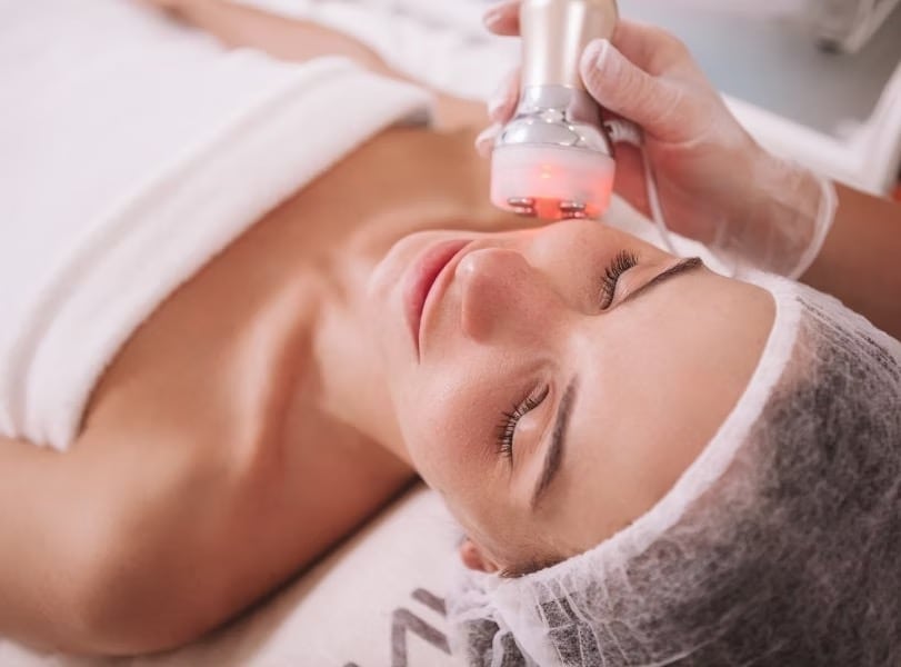 benefits rf skin tightening